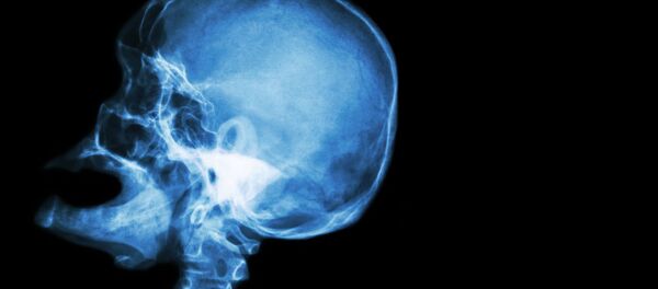 پیوند سر - اسپوتنیک افغانستان  