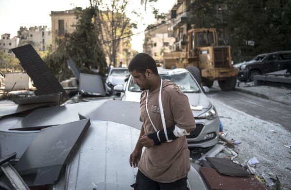 یکی از آسیب‌دیدگان انفجار بیروت، لبنان - اسپوتنیک افغانستان  