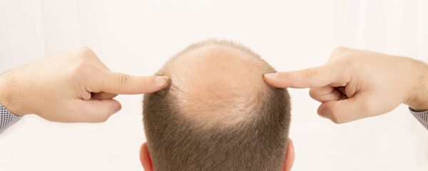 Лысый мужчина - اسپوتنیک افغانستان  