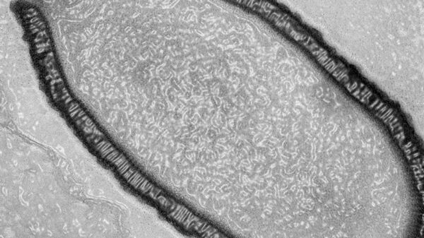 Питовирус в клетке зараженной амебы, снимок сделан при помощи электронного микроскопа   - اسپوتنیک افغانستان  