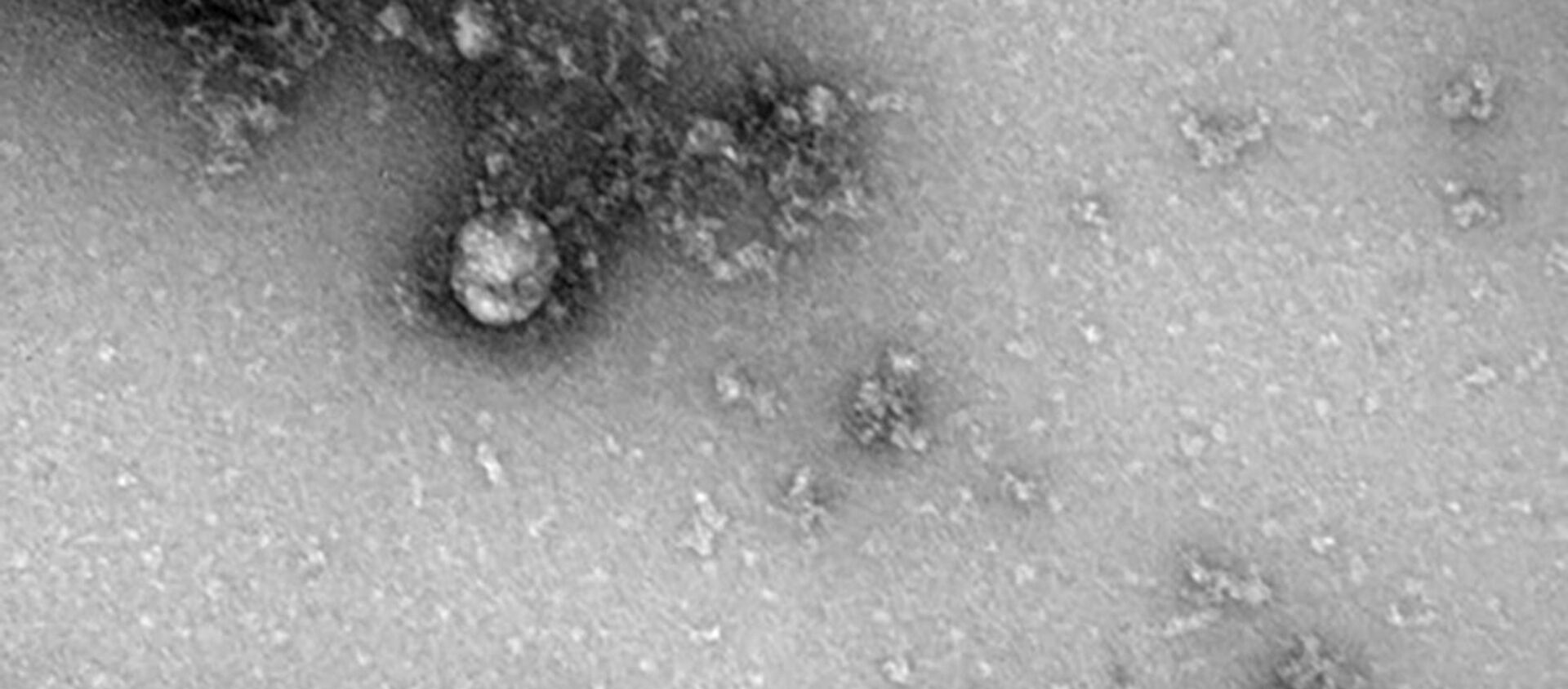 جهش جدید ویروس کرونا در انگلیس  - اسپوتنیک افغانستان  , 1920, 02.02.2021