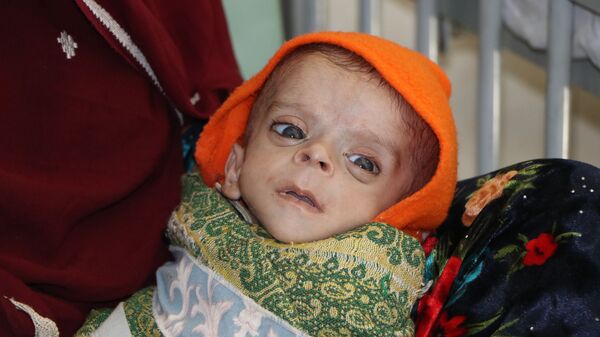 یونیسف: افغانستان بیشترین شمار کودکان مبتلا به سوءتغذیه در جنوب آسیا را دارد - اسپوتنیک افغانستان  