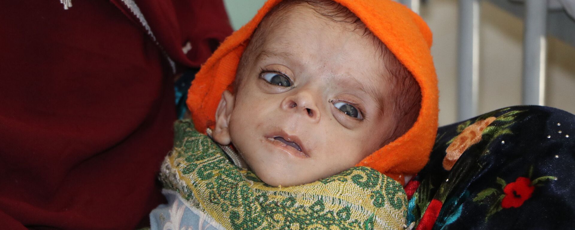 یونیسف: افغانستان بیشترین شمار کودکان مبتلا به سوءتغذیه در جنوب آسیا را دارد - اسپوتنیک افغانستان  , 1920, 23.12.2021