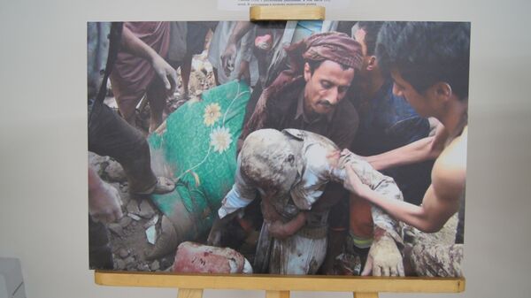 نمایشگاه عکس به مناسبت ششمین سالگرد آغاز بمباران ائتلاف عرب در یمن - اسپوتنیک افغانستان  