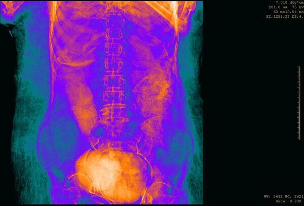  زن باردار مومیایی شده و اولین تصاویر رادیولوژی از  جنینی    - اسپوتنیک افغانستان  