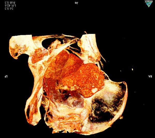  زن باردار مومیایی شده و اولین تصاویر رادیولوژی از  جنینی    - اسپوتنیک افغانستان  