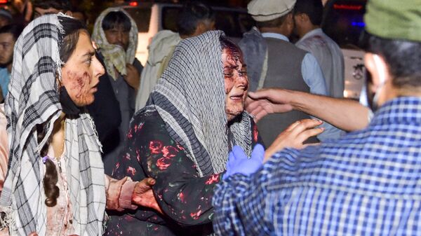 Женщины, раненые в результате двух мощных взрывов, произошедших в Кабуле - اسپوتنیک افغانستان  