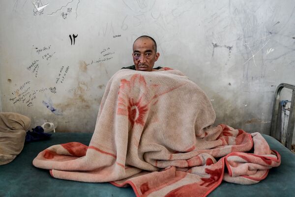 چگونگی درمان معتادان در بیمارستان ترک اعتیاد در کابل. - اسپوتنیک افغانستان  