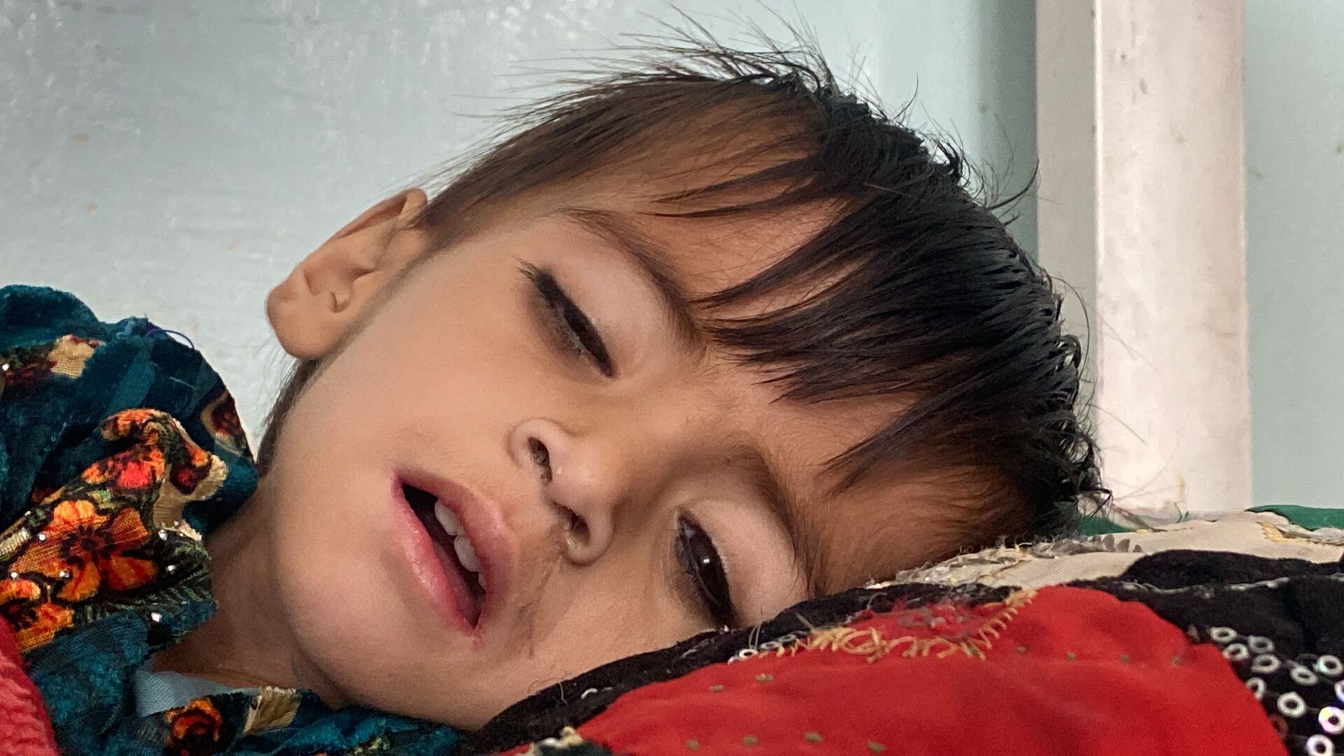 Опасность проблемы недоедания для афганских детей - اسپوتنیک افغانستان  , 1920, 19.01.2022