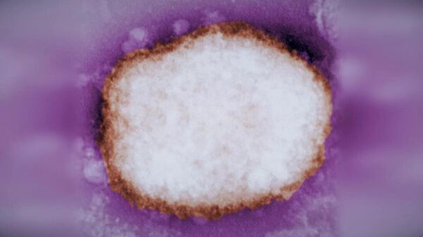 Вирус оспы обезьян под электронным микроскопом - اسپوتنیک افغانستان  
