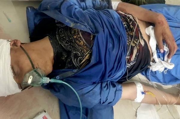 رسانهها در افغانستان تصاویری از حملات اخیر پاکستان به سه ولایت این کشور را به نشر رساند - اسپوتنیک افغانستان  