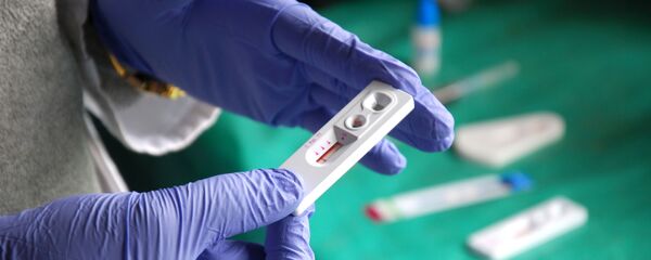 موثرترین واکسن مبارزه با ایدز ساخته شد موثرترین واکسن مبارزه با ایدز ساخته شد - اسپوتنیک افغانستان