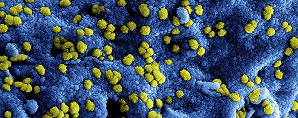 ویروس میرس در المان ویروس میرس در المان - اسپوتنیک افغانستان