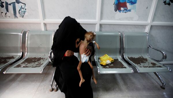 Женщина с ребенком в центре интенсивной терапии в Йемене - اسپوتنیک افغانستان  