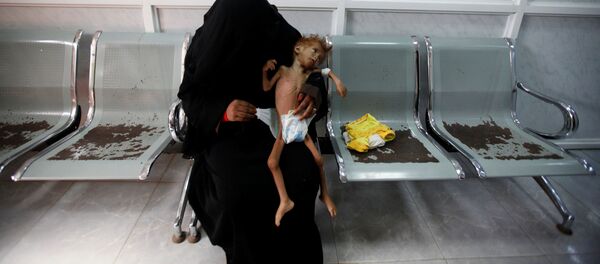 Женщина с ребенком в центре интенсивной терапии в Йемене Женщина с ребенком в центре интенсивной терапии в Йемене - اسپوتنیک افغانستان