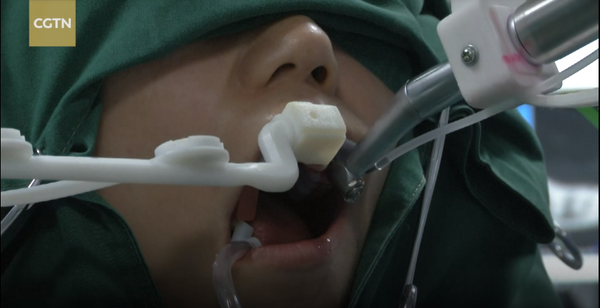 ربات داکتر دندان + ویدیو ربات داکتر دندان + ویدیو - اسپوتنیک افغانستان