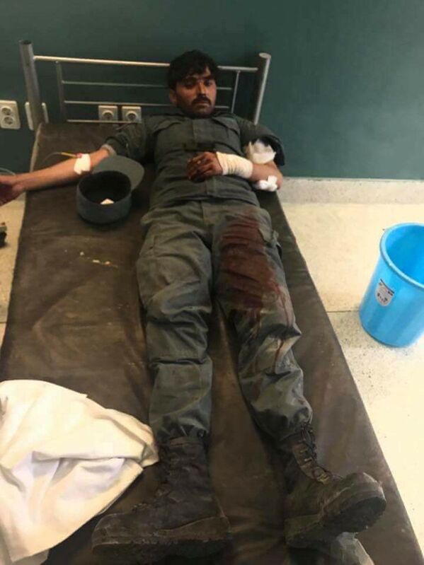 این مرد در اثر حمله طالبان در ولایت غزنی، افغانستان، به شدت زخم برداشته است - اسپوتنیک افغانستان  