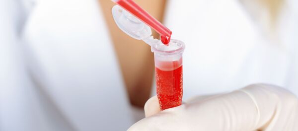 Анализ крови Анализ крови - اسپوتنیک افغانستان