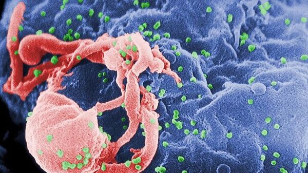 درمان دومین بیمار مبتلا به ایدز  - اسپوتنیک افغانستان  