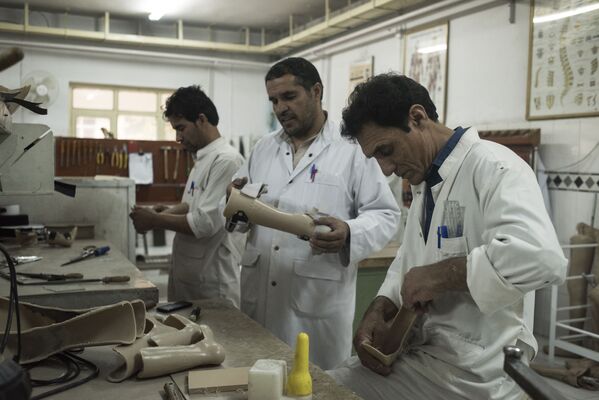 کارگاه تولید پروتز در کلینیک ارتوپدی در کابل. - اسپوتنیک افغانستان  