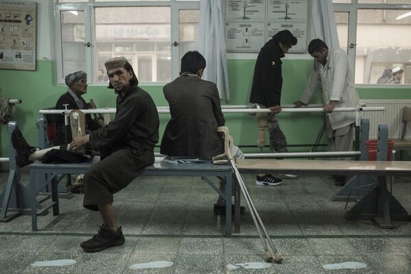 دکتر و بیمار کلینیک ارتوپدی در کابل. - اسپوتنیک افغانستان  