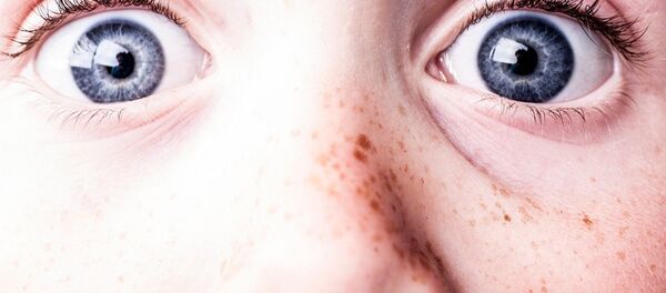 پیدا شدن کرم پرازیت چشم در روسیه + عکس پیدا شدن کرم پرازیت چشم در روسیه + عکس - اسپوتنیک افغانستان