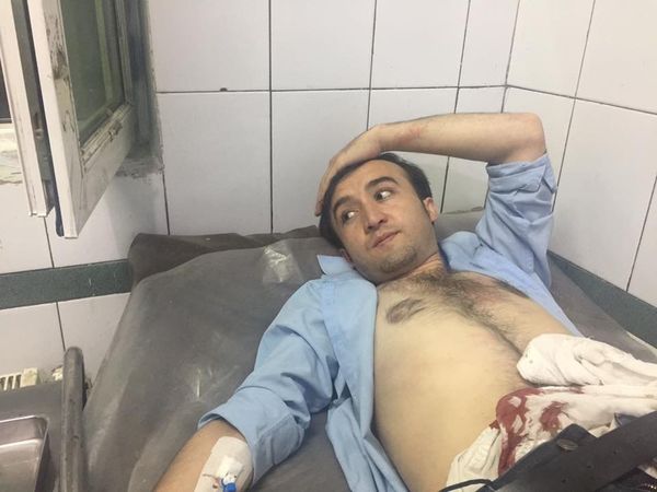 ارشاد زریز، خبرنگار تلویزیون نور که در نتیجه حمله مسلحانه زخمی شده است ارشاد زریز، خبرنگار تلویزیون نور که در نتیجه حمله مسلحانه زخمی شده است - اسپوتنیک افغانستان