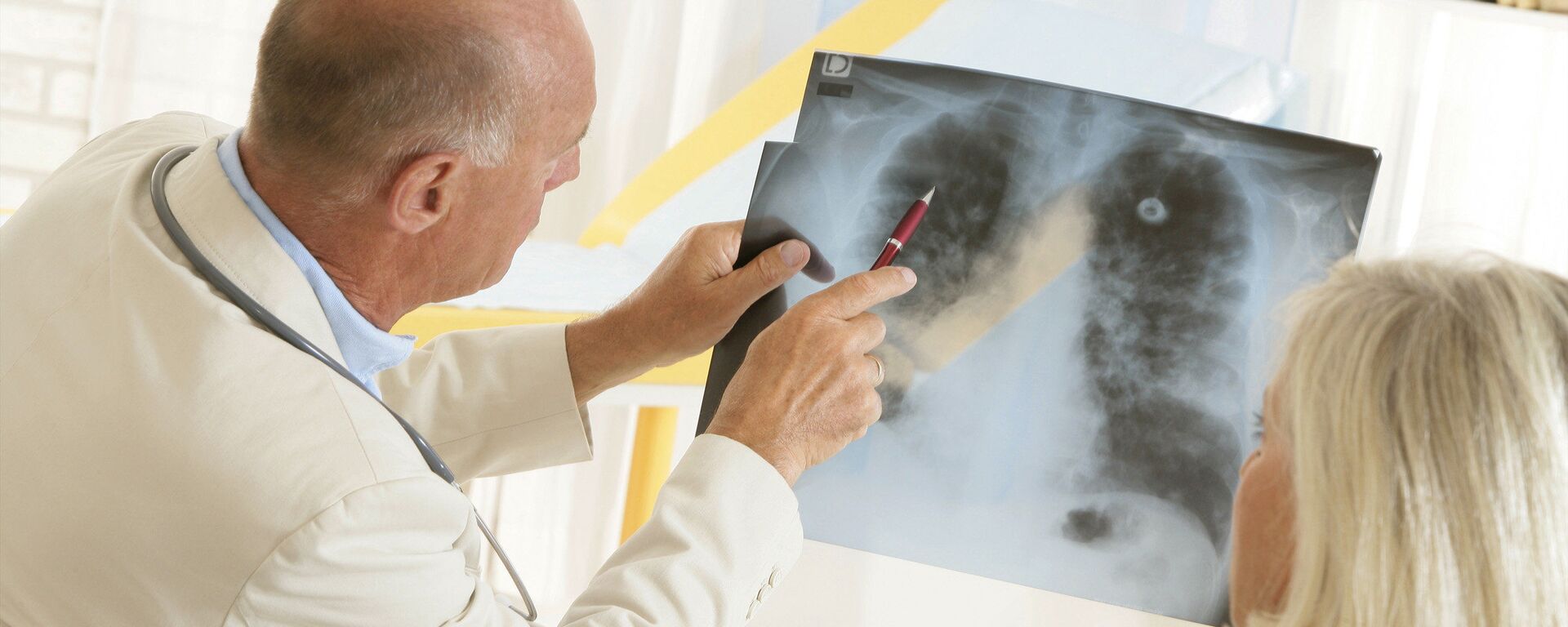 Врач показывает рентгеновский снимок легких пациенту - اسپوتنیک افغانستان  , 1920, 24.01.2022