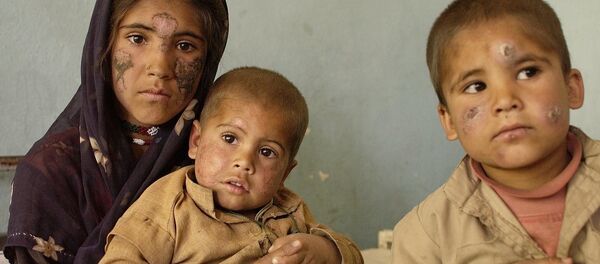 وضع دردناک کودکان افغان وضع دردناک کودکان افغان - اسپوتنیک افغانستان