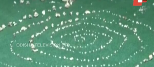 526 лишних зуба, извлеченные у индийского мальчика 526 лишних зуба, извлеченные у индийского мальчика - اسپوتنیک افغانستان