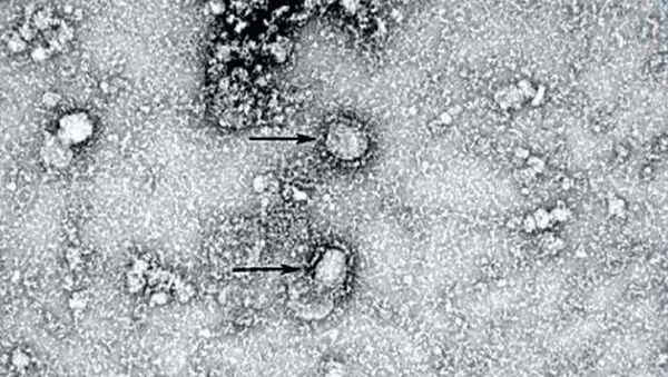  نخستین تصاویر از تکثیر کرونا ویروس  - اسپوتنیک افغانستان  