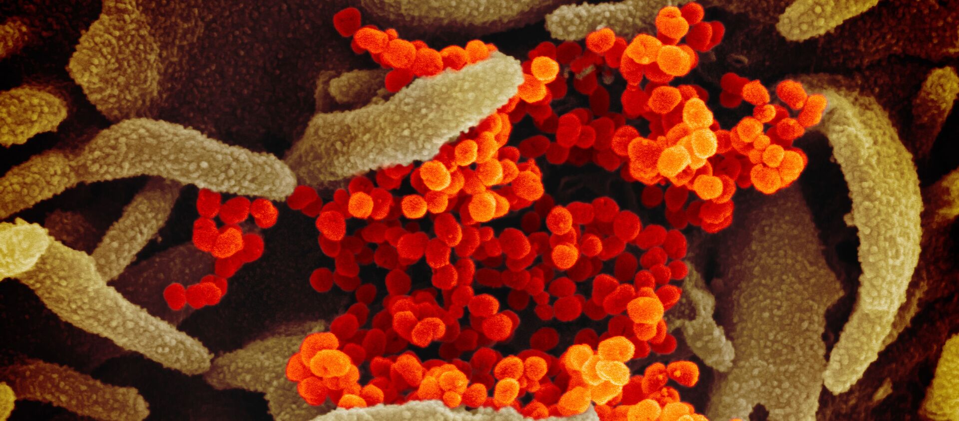  کشف آلوده ترین ویروس کرونا در اندونزی  - اسپوتنیک افغانستان  , 1920, 31.08.2020