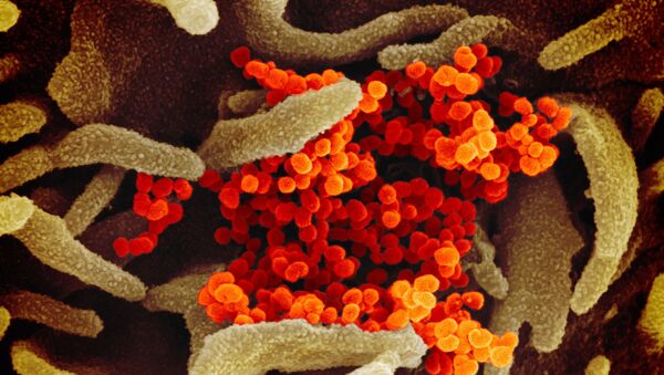 Цветное изображение нового коронавируса SARS-CoV-2  - اسپوتنیک افغانستان  