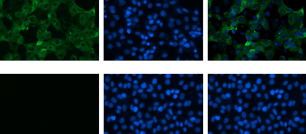 زمان ختم شیوع ویروس کرونا در جهان اعلام شد زمان ختم شیوع ویروس کرونا در جهان اعلام شد - اسپوتنیک افغانستان