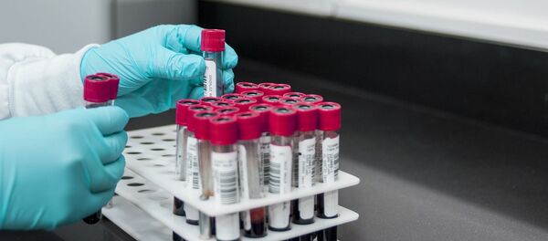 استفاده از خون بیماران بهبودیافته کرونا جهت مداوای بیماران جدید در امریکا - اسپوتنیک افغانستان  