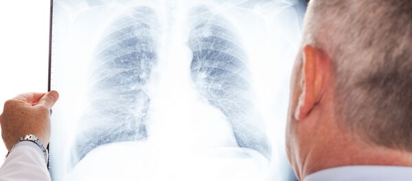 راهی نجات ریه ها از کرونا پیدا شد راهی نجات ریه ها از کرونا پیدا شد - اسپوتنیک افغانستان