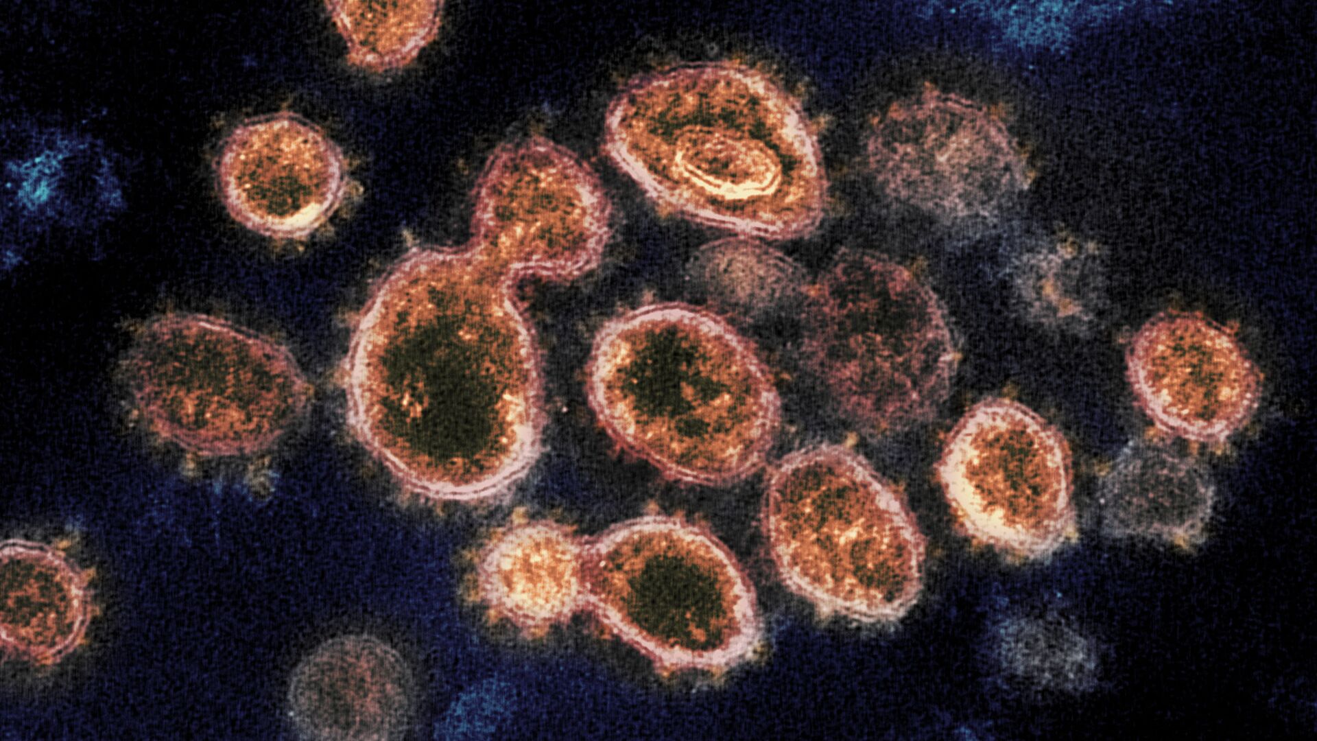 اولین موارد «عفونت ابدی»  ویروس کرونا شناسایی شد - اسپوتنیک افغانستان  , 1920, 04.03.2021