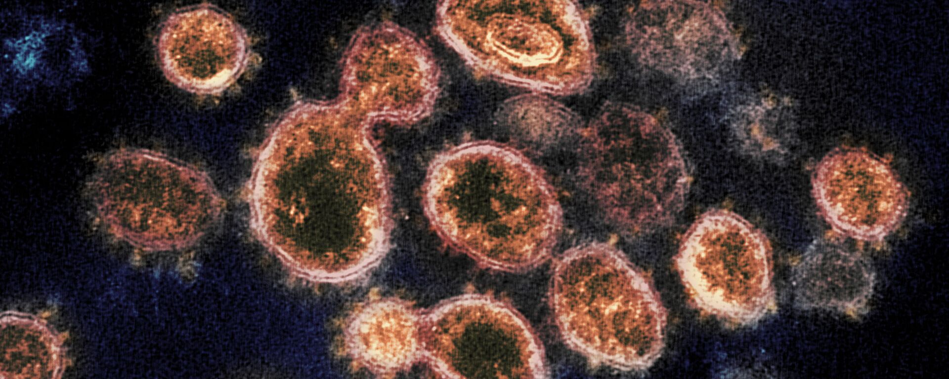  شناسایی ویروس جهش یافته کرونا انگلیس در ترکیه - اسپوتنیک افغانستان  , 1920, 01.01.2021
