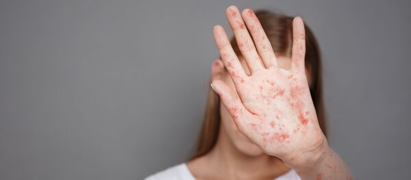 علائم جدید کرونا که پزشکان را گیج کرده است علائم جدید کرونا که پزشکان را گیج کرده است - اسپوتنیک افغانستان