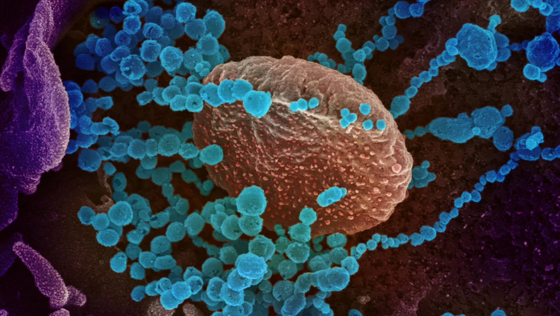 سرچشمه تازه ای پیدایش ویروس کرونا 