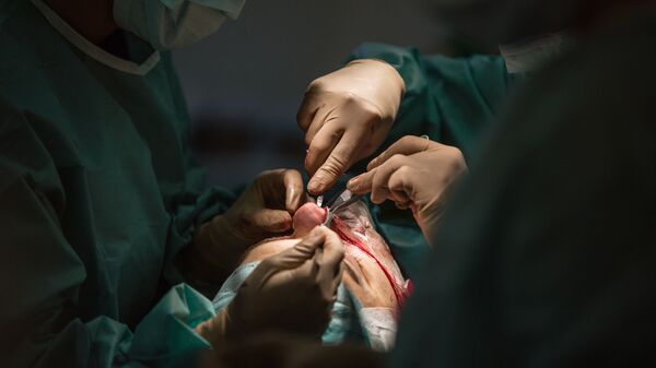 Пластическая операция по изменению формы носа - اسپوتنیک افغانستان  