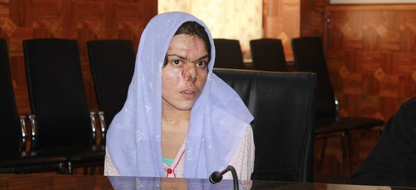 ریزهگل پس از هفتبار عمل جراحی، بینیاش را بدست آورد ریزهگل پس از هفتبار عمل جراحی، بینیاش را بدست آورد - اسپوتنیک افغانستان