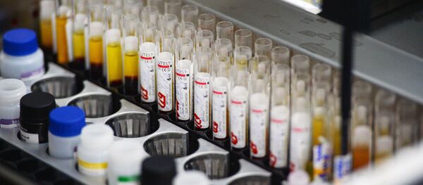 تعداد بیماران مبتلا به «ایدز» در افغانستان اعلام شد تعداد بیماران مبتلا به «ایدز» در افغانستان اعلام شد - اسپوتنیک افغانستان