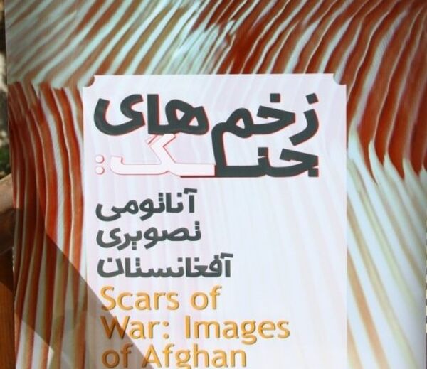 نمایش زخم‌های جنگ در کابل - اسپوتنیک افغانستان  